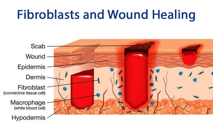 Role of fibroblasts in wound healing