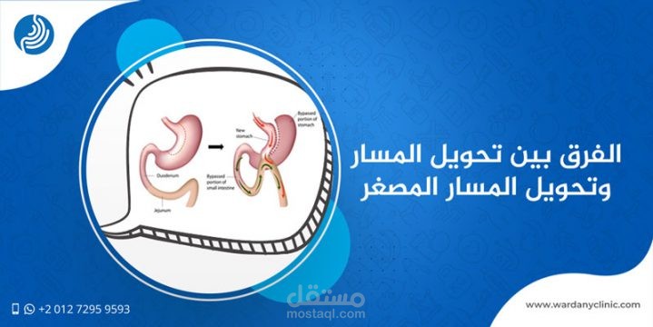 عملية تحويل المسار