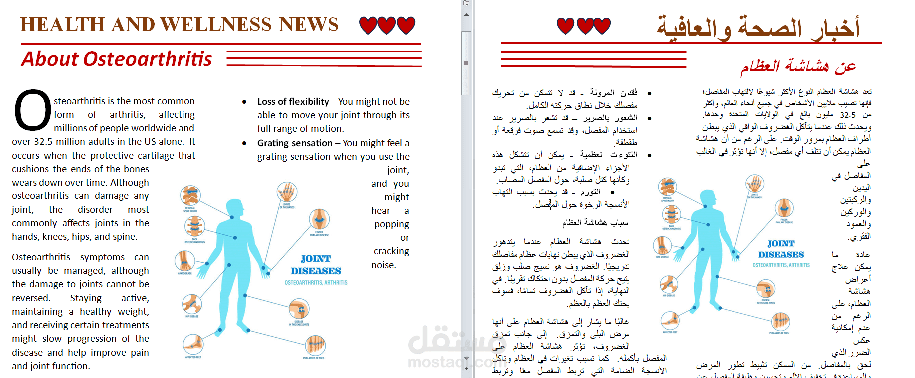 ترجمة مقالة عن هشاشة العظام