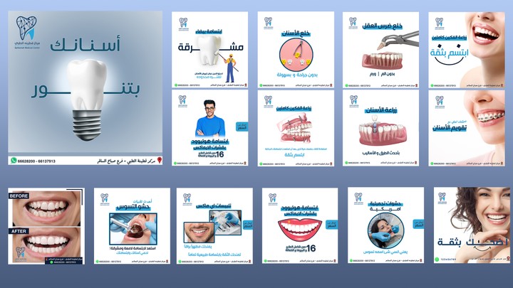 بوستات سوشيال ميديا ل عيادة اسنان