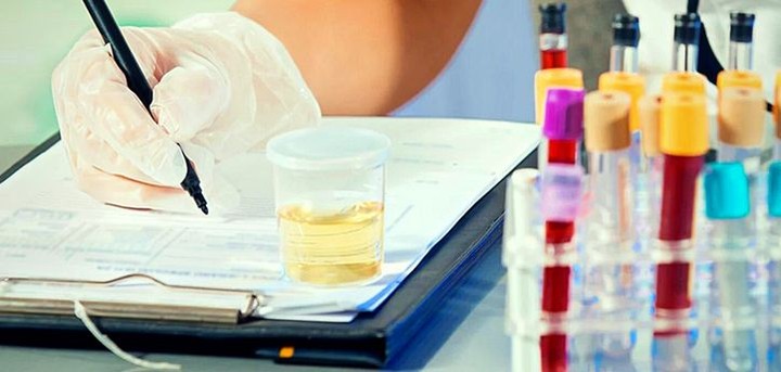 تفاصيل عن اختبار الأسمولية (Osmolality Test)