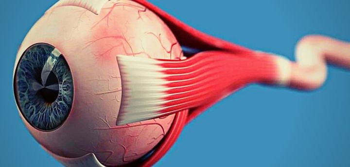 وذمة حليمة العصب البصري (Optic Nerve Swelling)