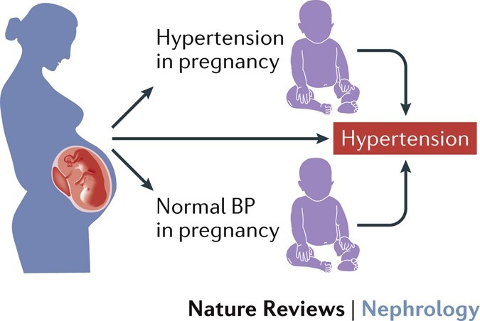 medical report in english /Relation of hypertension and pregnancy.