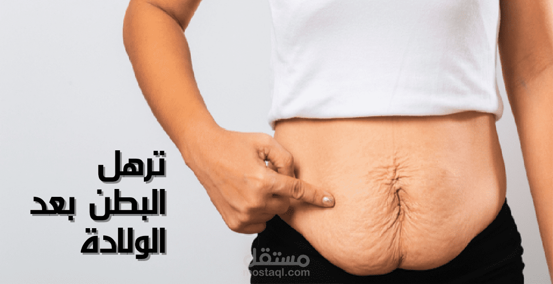 ترهل البطن بعد الولادة