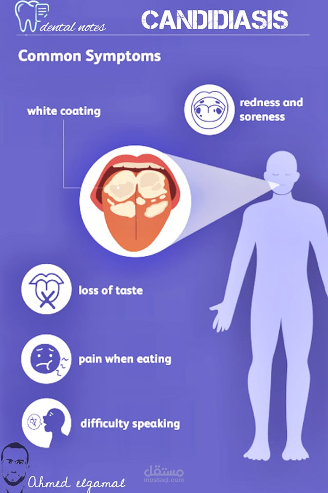 candidiasis