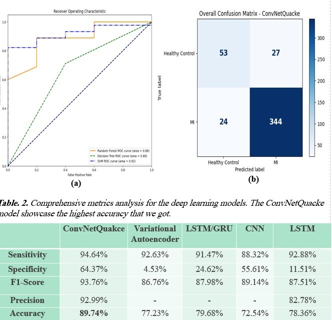 Heart Disease Classification Using ECG Signals