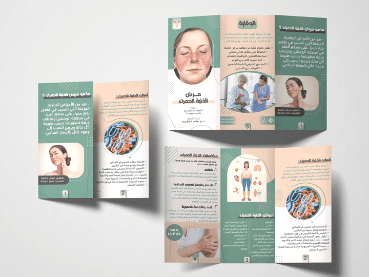 بروشور توعوي لمرض الذئبة الحمراء - Awareness brochure about red lupus