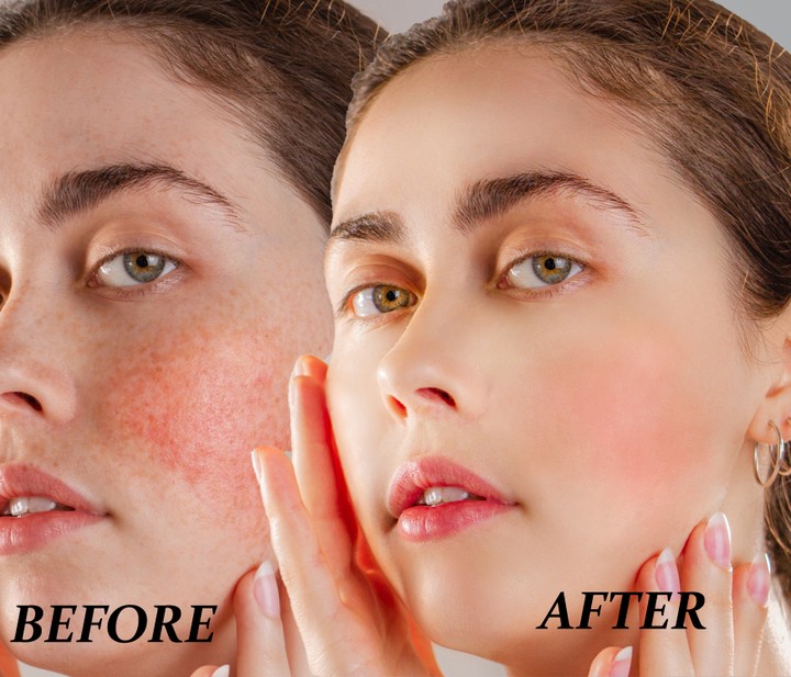 Retouch and light Face