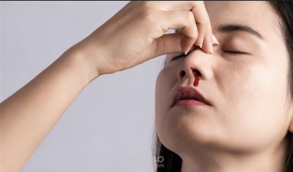 مقال صحي عن نزيف الأنف وكيفية التعامل معه بسلامة. | مستقل