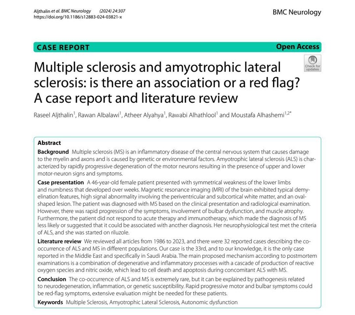 Research study - BMC Neurology - Literature Review and Case Report - Multiple sclerosis and amyotrophic lateral sclerosis: is there an association or a red flag? A case report and literature review