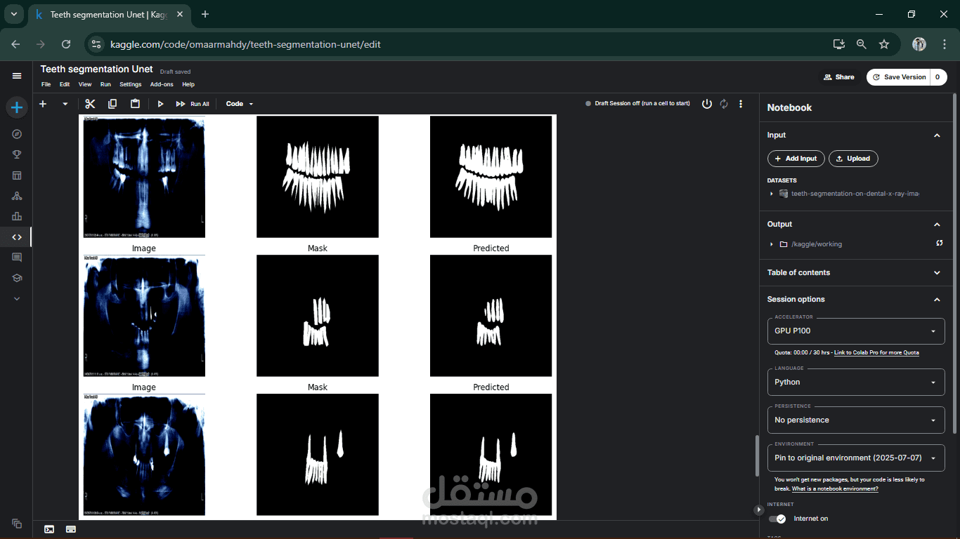 Panorama Teeth segmentation :