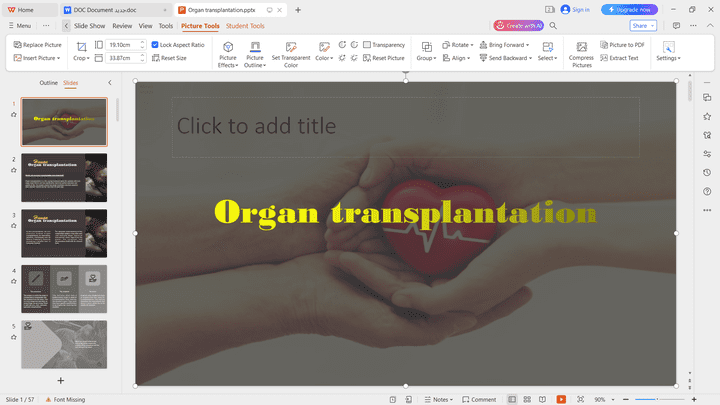 عمل عرض تقديمي عن زراعة الاعضاء
