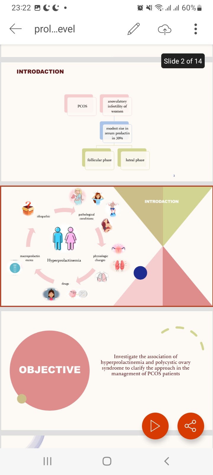 Prolactin Level in Polycystic Ovary Syndrome (PCOS)