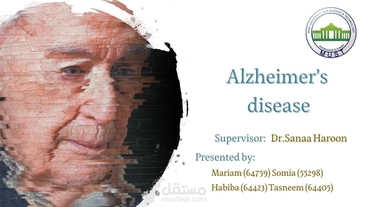 عرض تقديمي عن " Alzheimer’s disease "