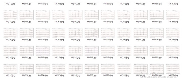 تصنيف أمراض القلب حسب صور تخطيط قلب بالذكاء الأصطناعي