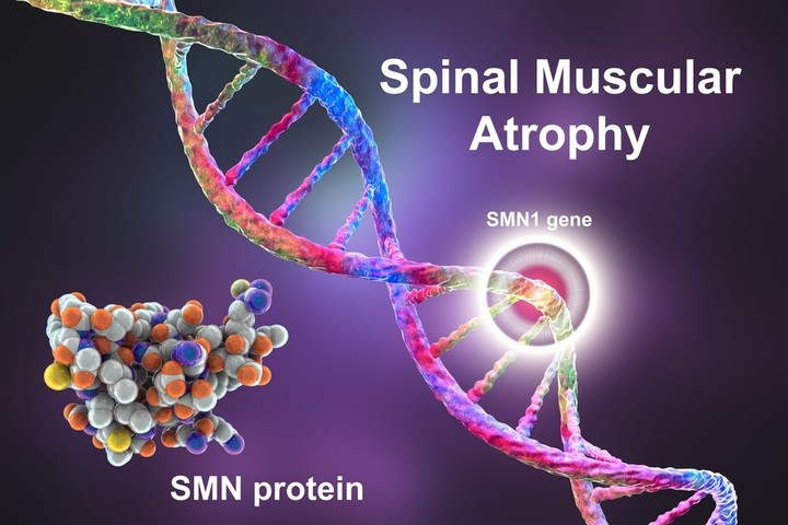 Research about spinal mascular atrophy