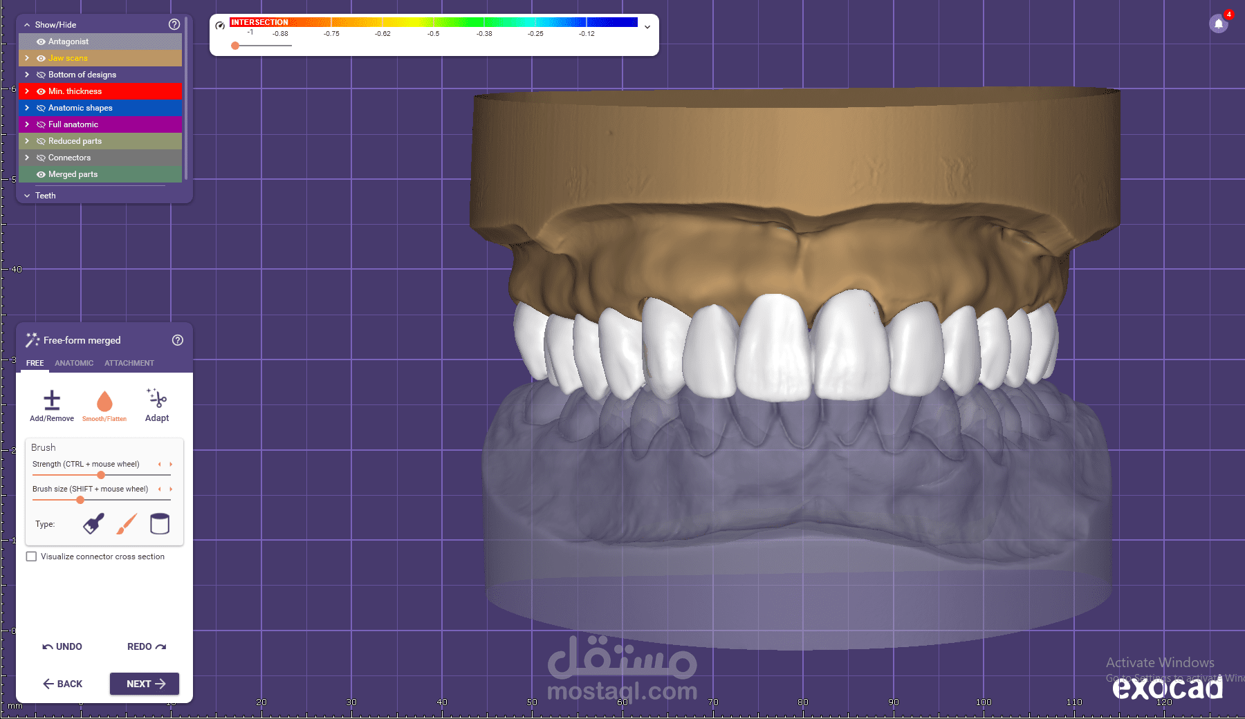تصميم تيجان وجسور الأسنان باحترافية عبر ExoCAD
