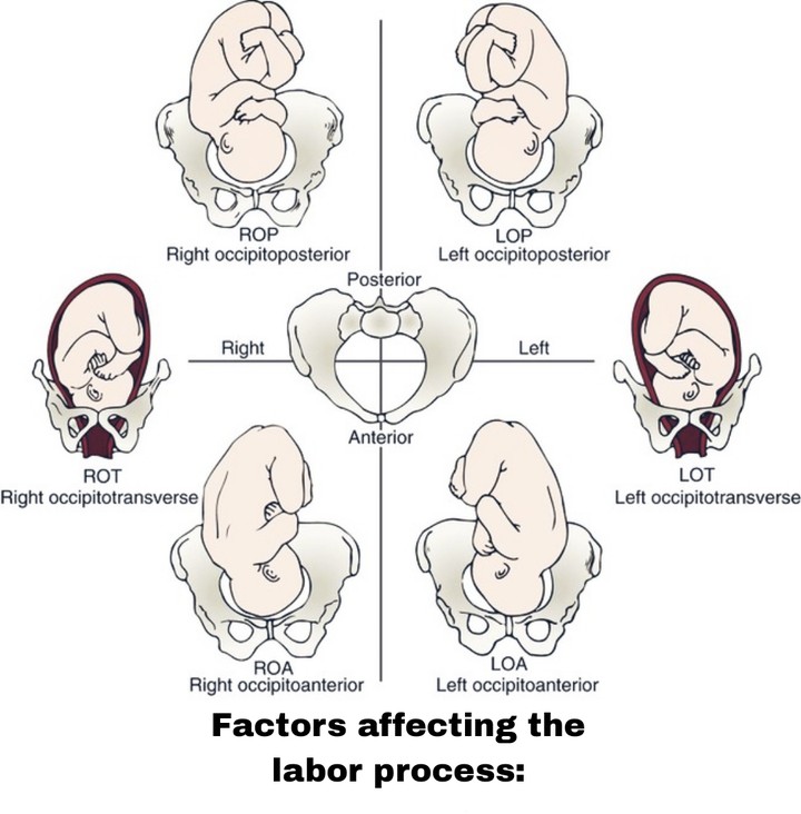 Factors affecting the labor process