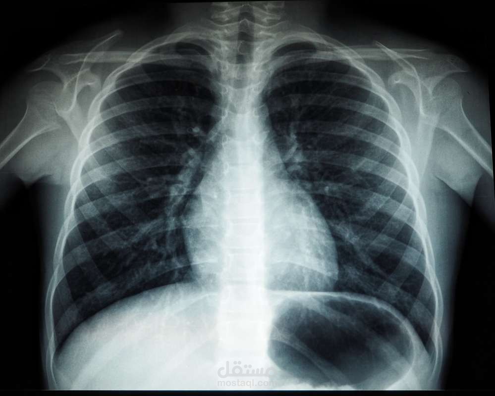 Clustering Medical Images Using Machine Learning Techniques