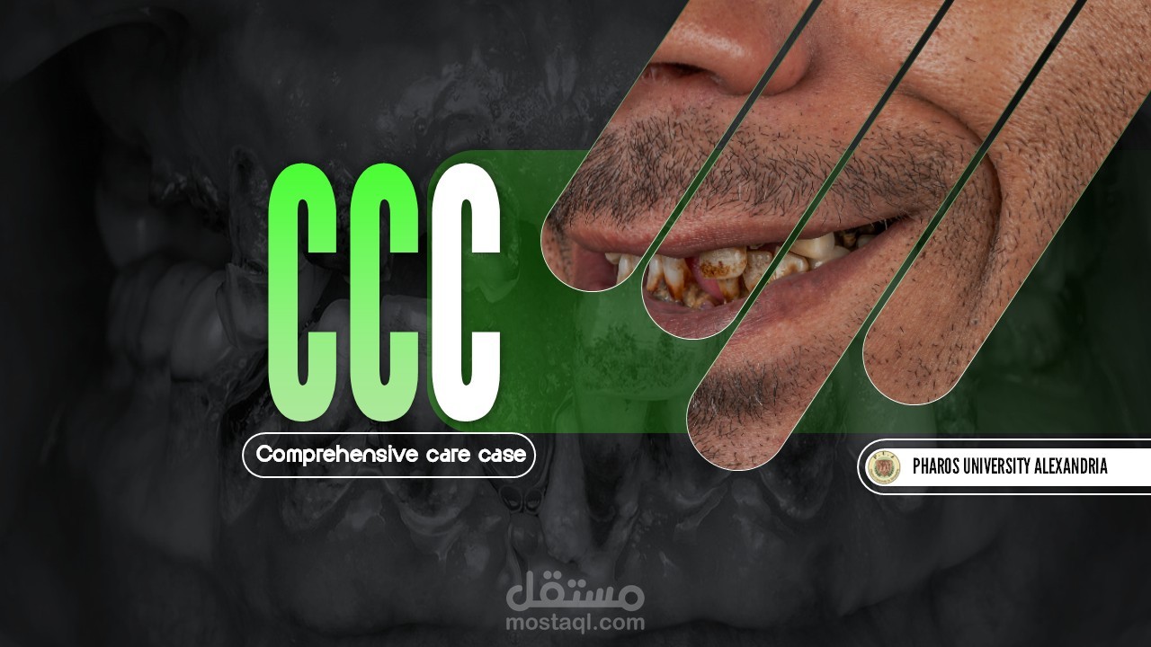 عرض تقديمي لحالة تخرج طبيب اسنان