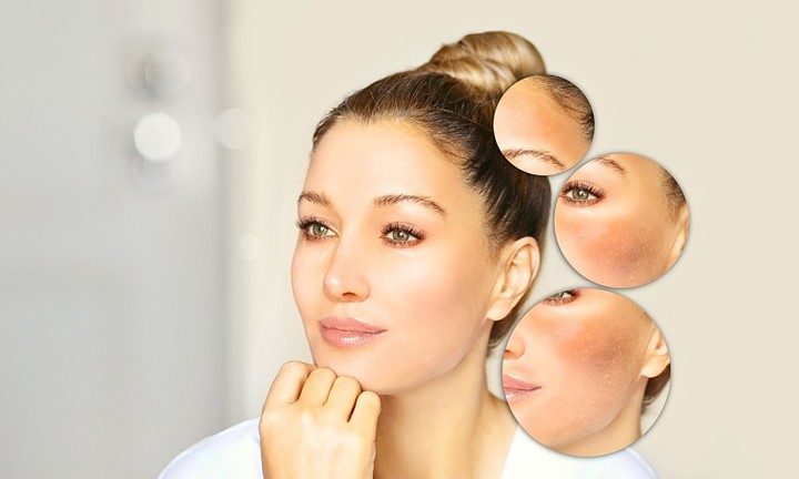 خلطات طبيعية لتفتيح البشرة: إليك افضل 12 وصفة طبيعية لتفتيح الوجه