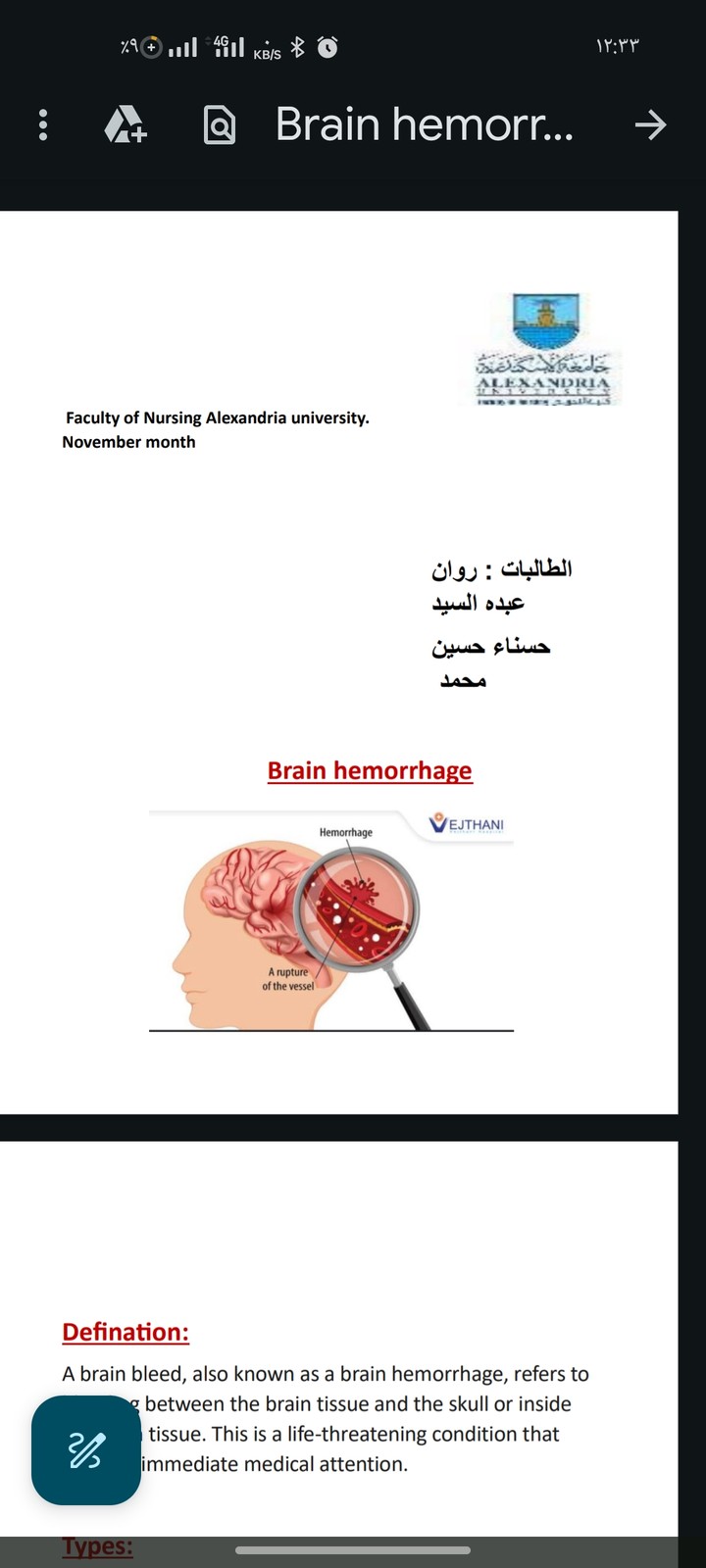 قام احد الطلاب بكلية تمريض الاسكندرية بطلب مني عمل بحث عن "brain hemorrhage"