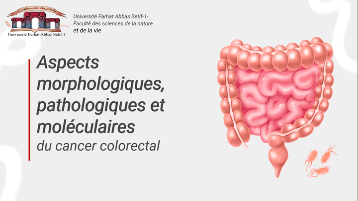 Aspects morphologiques, pathologiques et moléculairesn du cancer colorectal