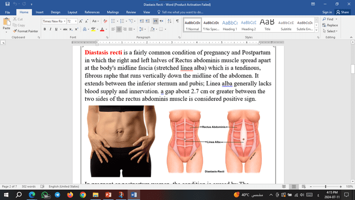 بحث بسيط عن Diastasis Recti