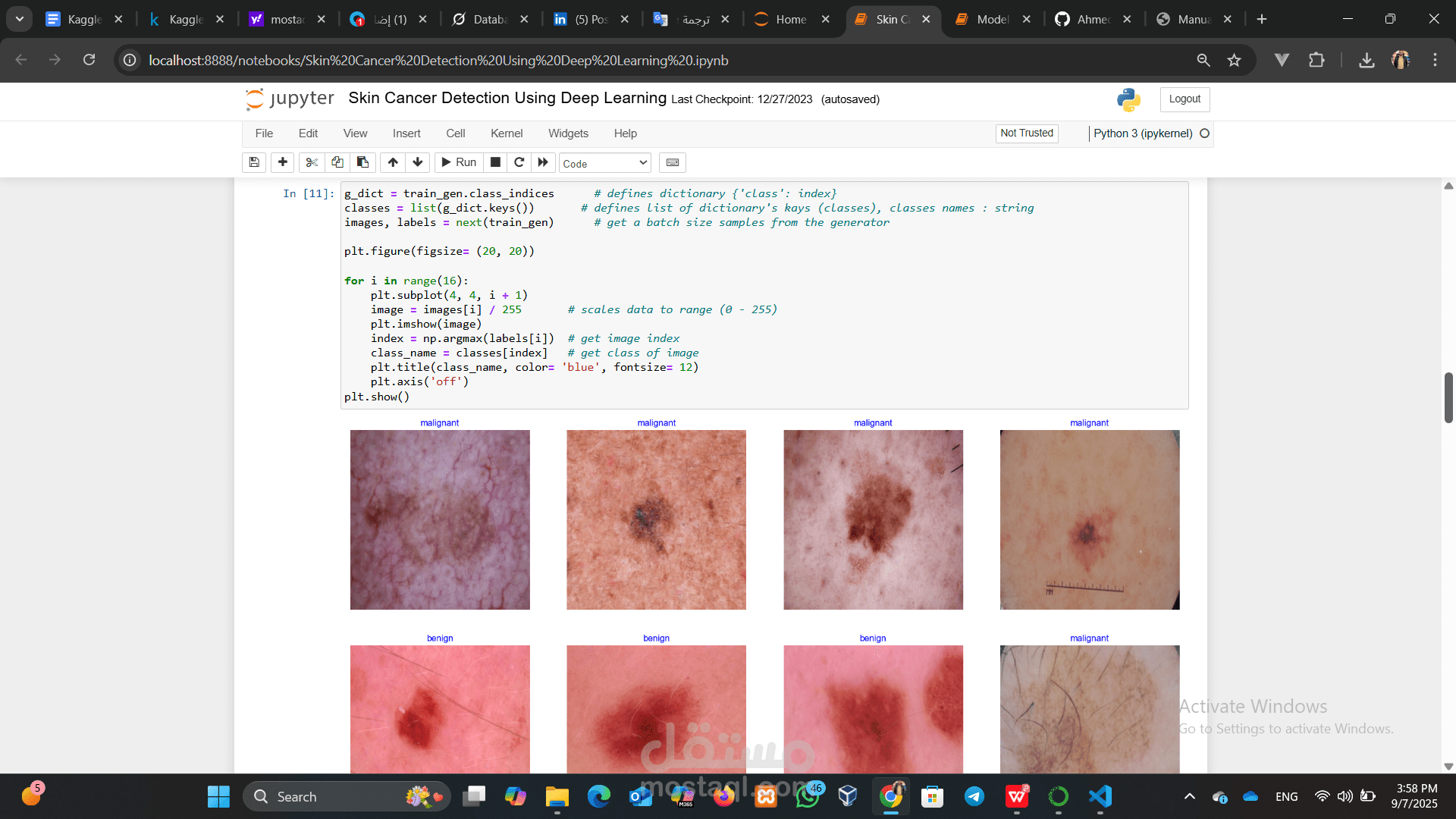 Skin Cancer Detection