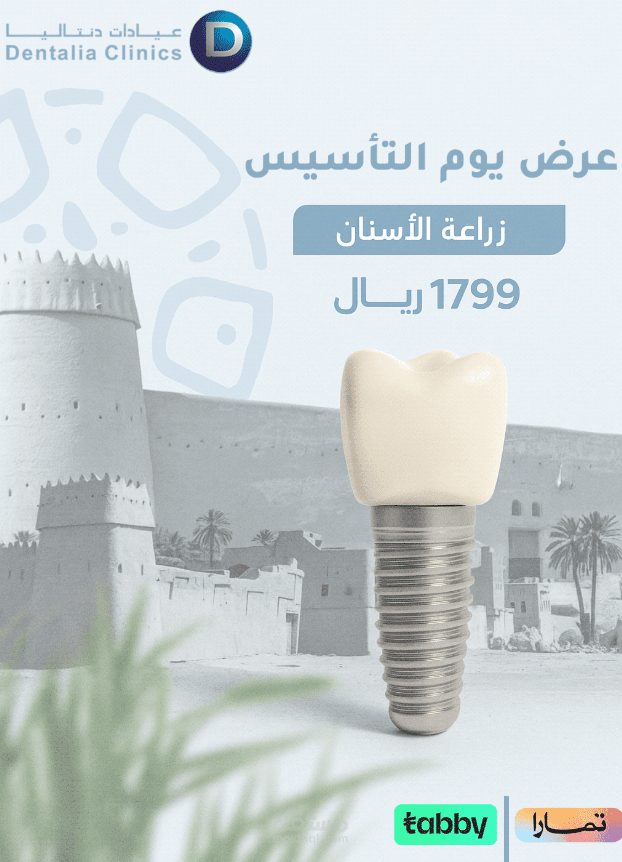 إعلان عرض زراعة الأسنان