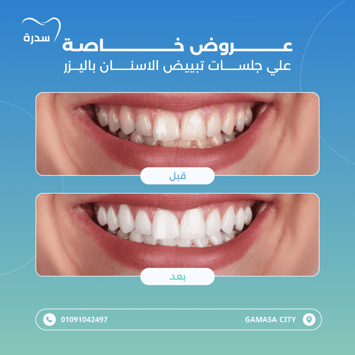 تصاميم سوشيال ميديا لعيادة سدرة لطب الأسنان