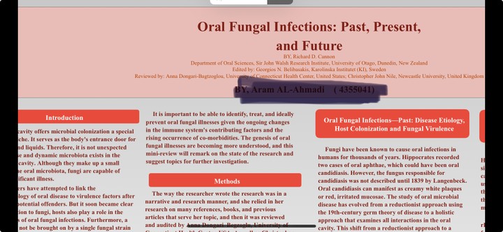 oral fungle Infection