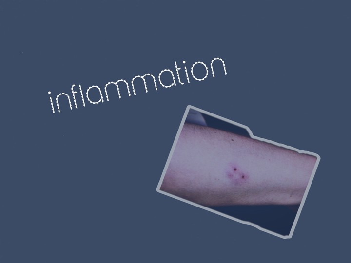 Inflammation/pathology summary in points as scientific term