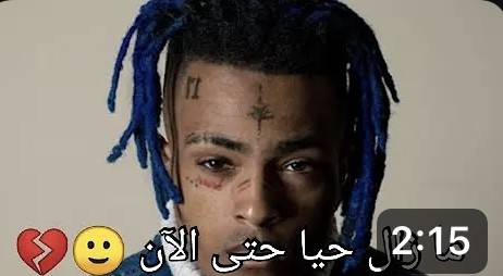 حقيقة وفاة المغني الاميركي xxxtentacion