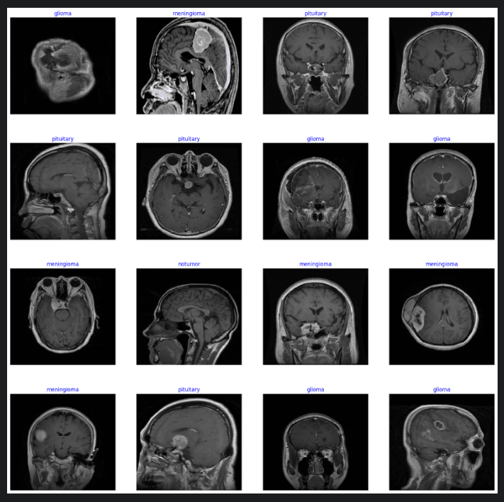 تمييز بين أورام المخ المختلفة و اذا هناك ورم ام لا من خلال صور MRI