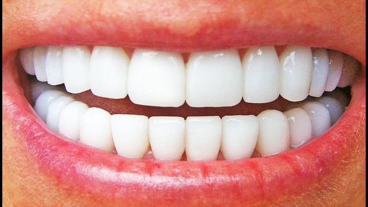 10 Natural Ways to Whiten Teeth