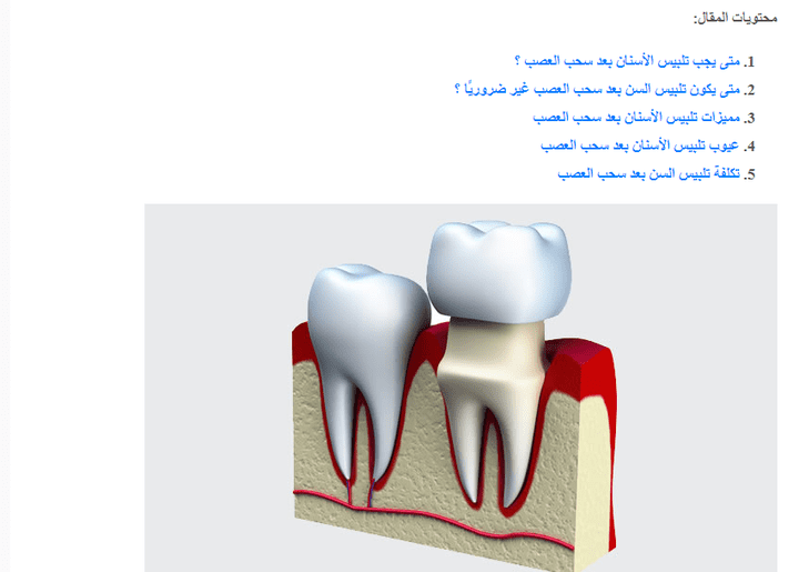 مقال عن تلبيس الأسنان بعد سحب العصب
