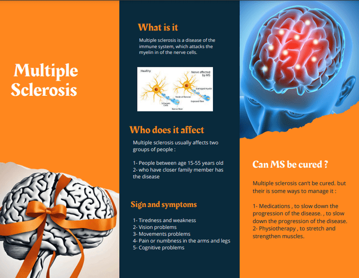 Multiple Sclerosis