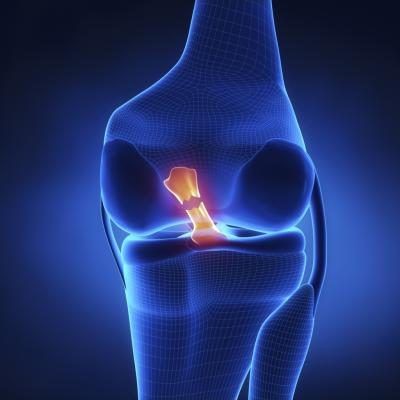 ACL rehabilitation