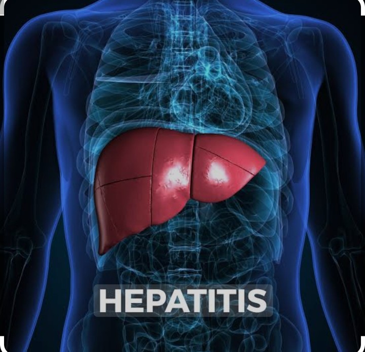 بحث عن مرض التهاب الكبد الوبائي وانواعه (Hepatitis)