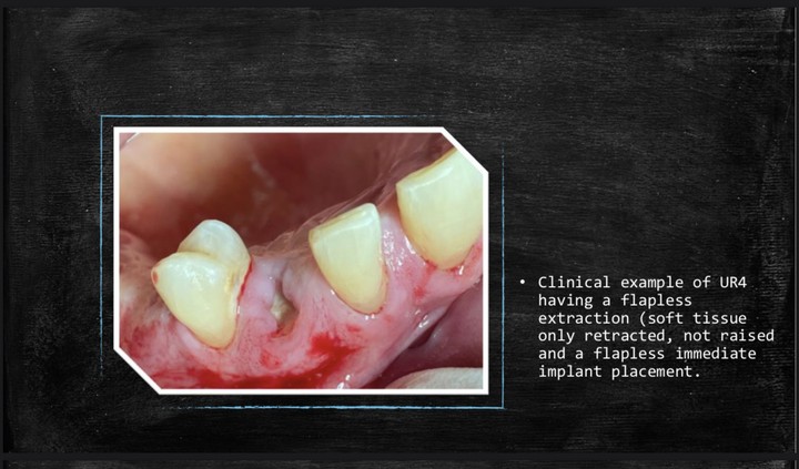 باور بوينت طبى يوضح التقنيات الحديثة الجراحية لطب الاسنان