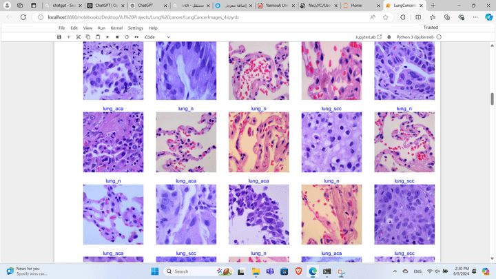 Lung cancer classification using deep learning