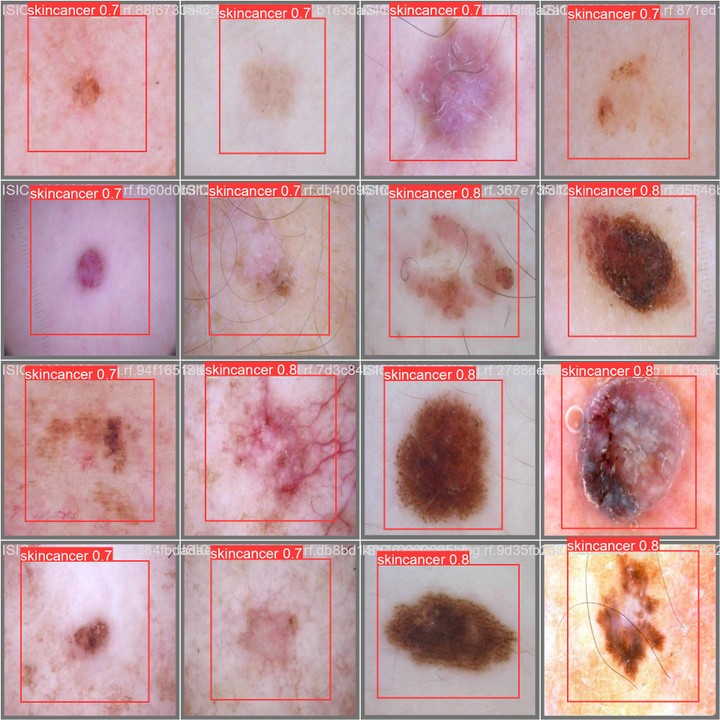 Skin cancer detection using yolov9