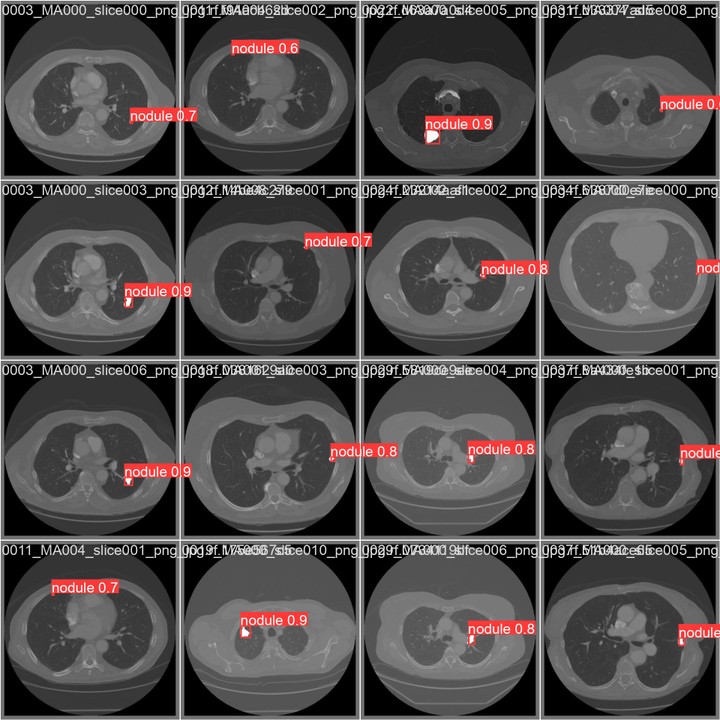 Enhanced detection of lung cancer using yolov9