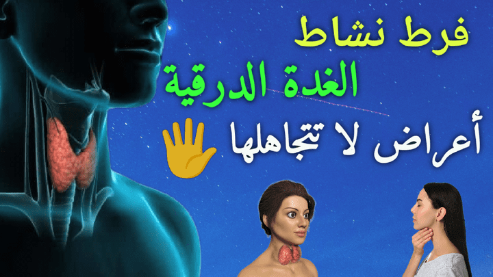 فرط نشاط الغدة الدرقية واعراضها