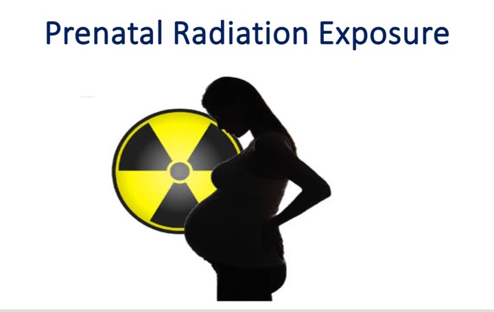 Prenatal Radiation Exposure