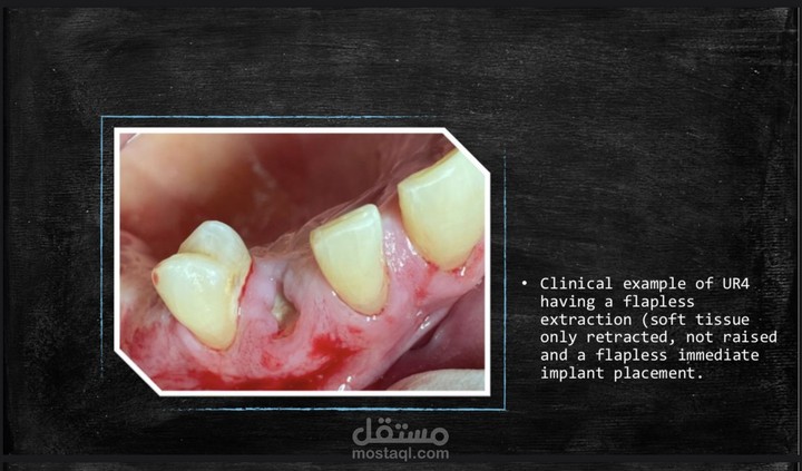 باور بوينت طبى يوضح التقنيات الحديثة الجراحية لطب الاسنان