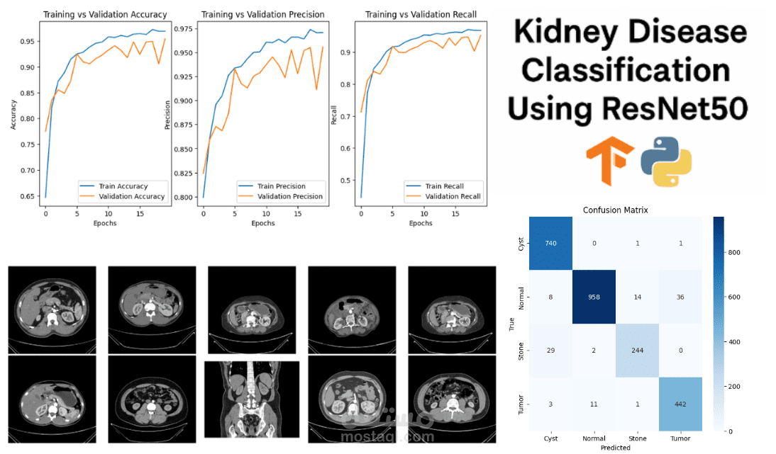 Kidney Disease Classification