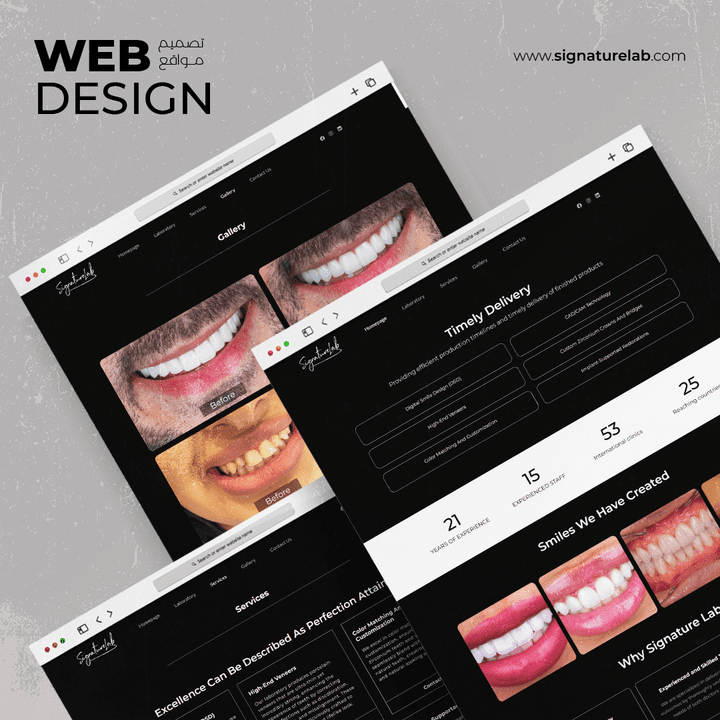 تصميم موقع الكتروني لمختبر أسنان "signaturelab"