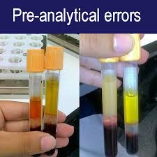 pre-analytical laboratory errors